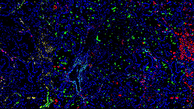 Aperte le iscrizioni alla seconda edizione del corso "The Power of Advanced Multiplexed Imaging"