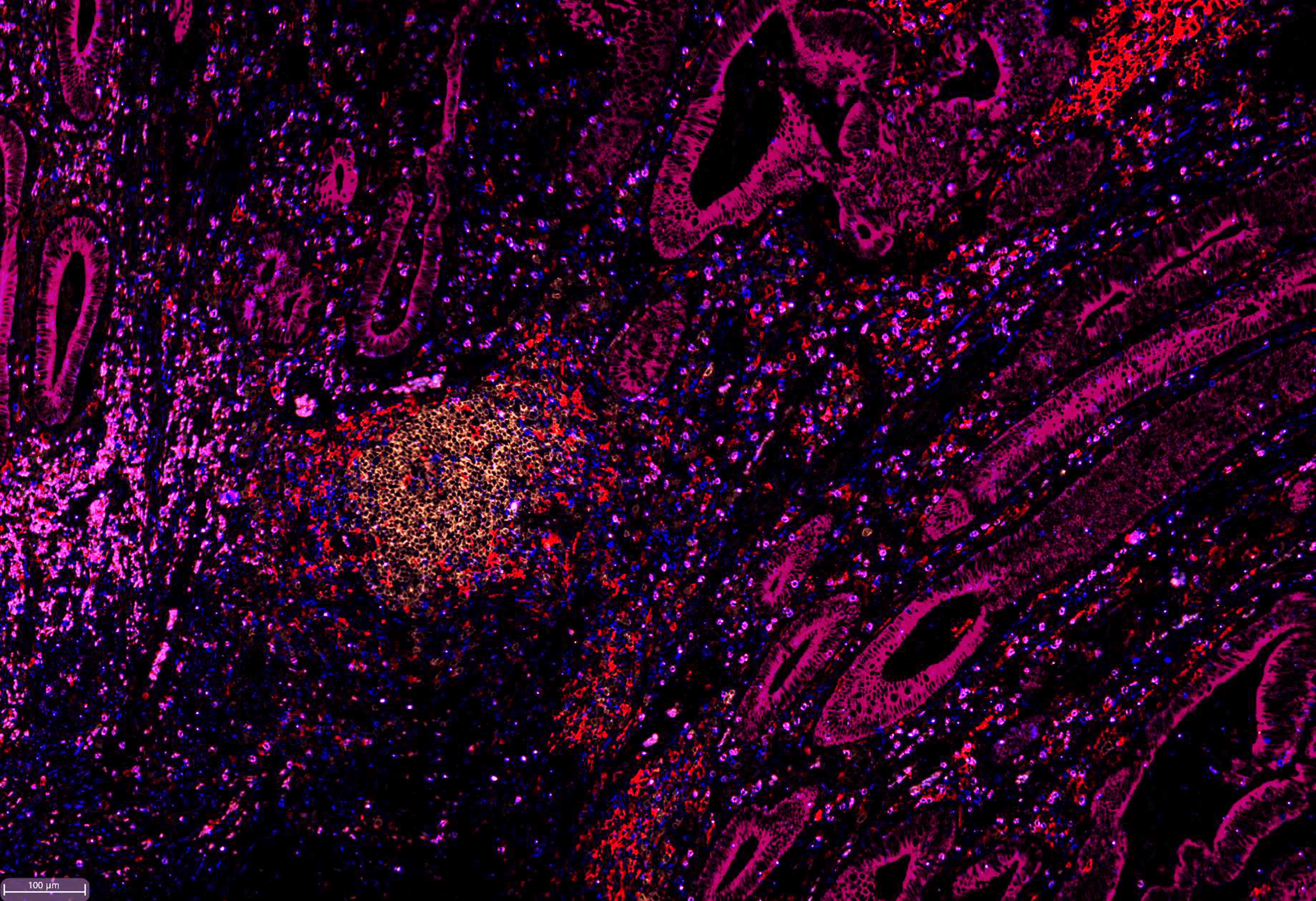Cover image for The power of advanced multiplexed imaging