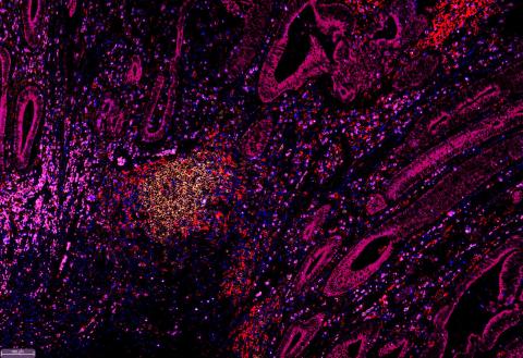 The Power of Advanced Multiplexed Imaging